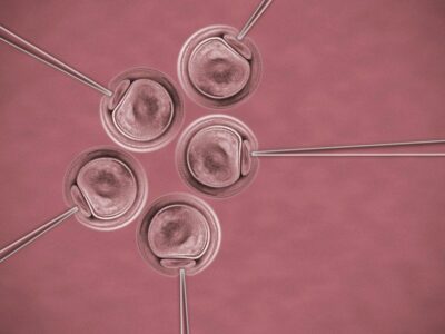 La activación asistida de los óvulos mejora la calidad de los embriones en mujeres de edad avanzada, según una técnica del Dr. Jan Tesarik
