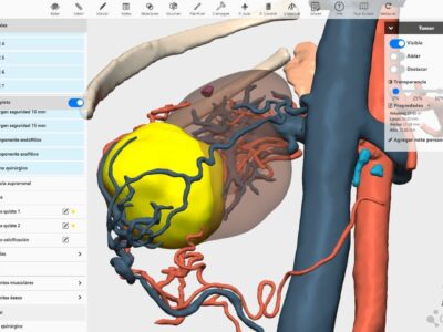 La integración de la IA en modelos 3D permitirá detectar anomalías congénitas en niños, según expertos del Congreso de la SECP