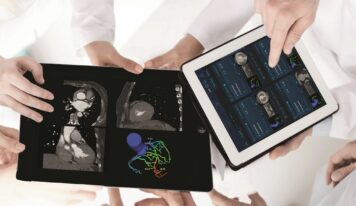 Un software con IA permite reducir en más del 60% el número de cateterismos diagnósticos innecesarios